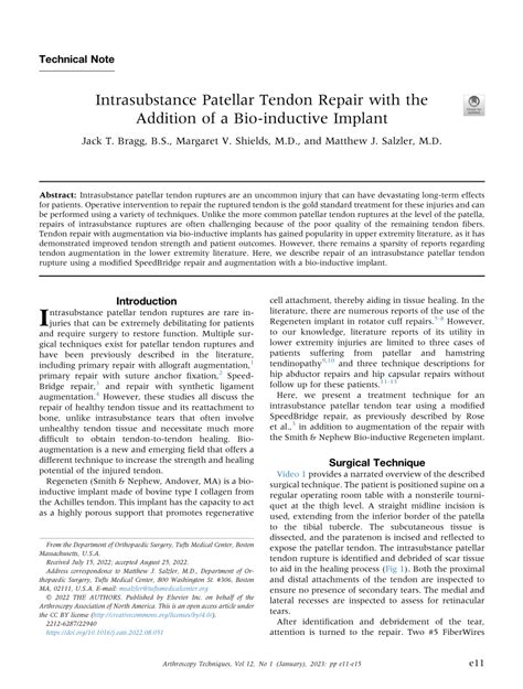 Intrasubstance Patellar Tendon Repair with the Addition of a Bio .